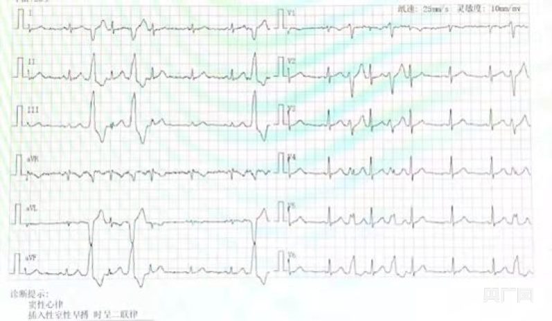 患者入院心电图报告(央广网发 受访者供图)