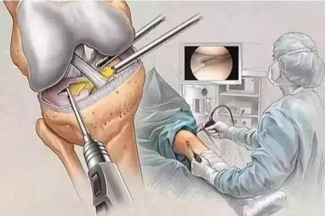 老年健康杀手!我国超过1亿患者!家里有老人的一定要看休闲区蓝鸢梦想 - Www.slyday.coM 老年健康杀手!我国超过1亿患者!家里有老人的一定要看休闲区蓝鸢梦想 - Www.slyday.coM