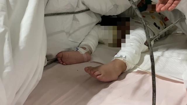 心疼!渭南一岁宝宝坐进开水盆,半身大面积烫伤......休闲区蓝鸢梦想 - Www.slyday.coM 心疼!渭南一岁宝宝坐进开水盆,半身大面积烫伤......休闲区蓝鸢梦想 - Www.slyday.coM