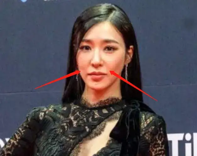 好多整容脸！外网曝<a href=