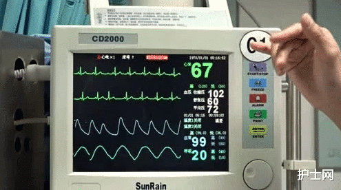 关于心电监护的这些事儿,你都知道吗?|监护仪|电极片