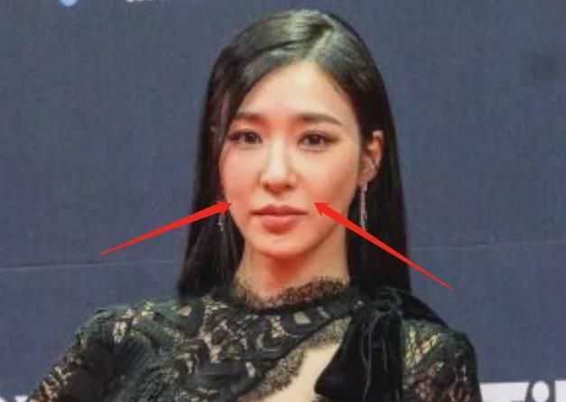 好多整容脸!外网曝<a href=