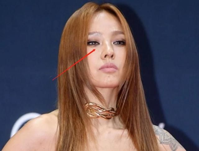 好多整容脸!外网曝<a href=