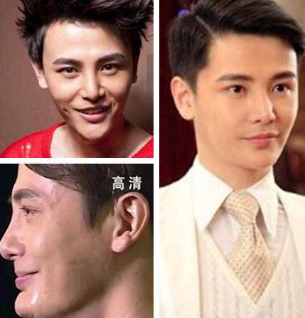 娱乐圈男星鼻子大pk有人假到离谱有人高出天际