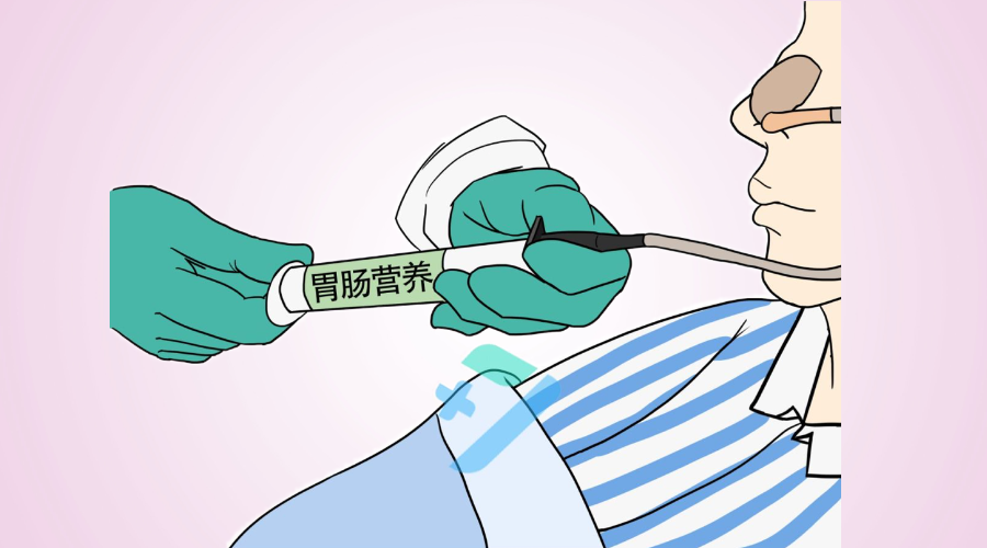 80的护士不知道的鼻饲六大并发症第5种最危险