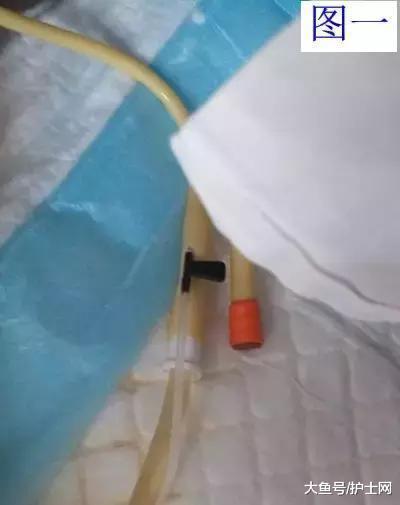膀胱冲洗差点导致针刺伤