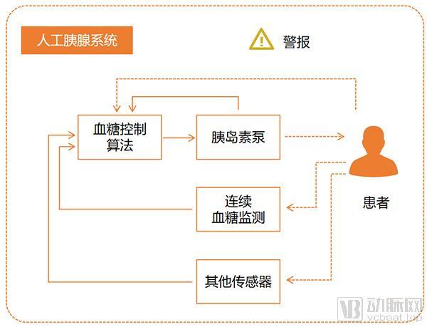 人工胰腺的工作流程,动脉网制图
