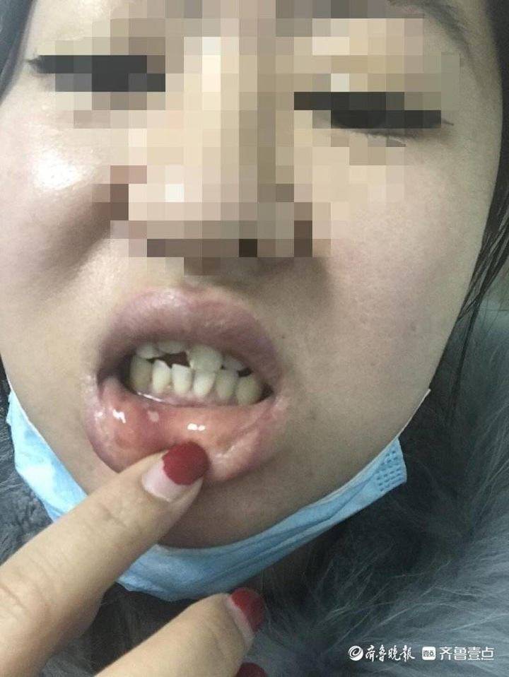 济南一小区物业在停车位安装U形挡车器,女子路过被绊倒摔断门牙休闲区蓝鸢梦想 - Www.slyday.coM 济南一小区物业在停车位安装U形挡车器,女子路过被绊倒摔断门牙休闲区蓝鸢梦想 - Www.slyday.coM