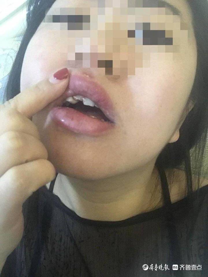 济南一小区物业在停车位安装U形挡车器,女子路过被绊倒摔断门牙休闲区蓝鸢梦想 - Www.slyday.coM 济南一小区物业在停车位安装U形挡车器,女子路过被绊倒摔断门牙休闲区蓝鸢梦想 - Www.slyday.coM