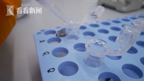 英国为全球首个新冠病毒“人体试验”招募志愿者