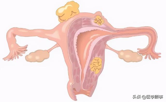 The Lancet：法国首个接受子宫移植的女性成功诞下婴儿