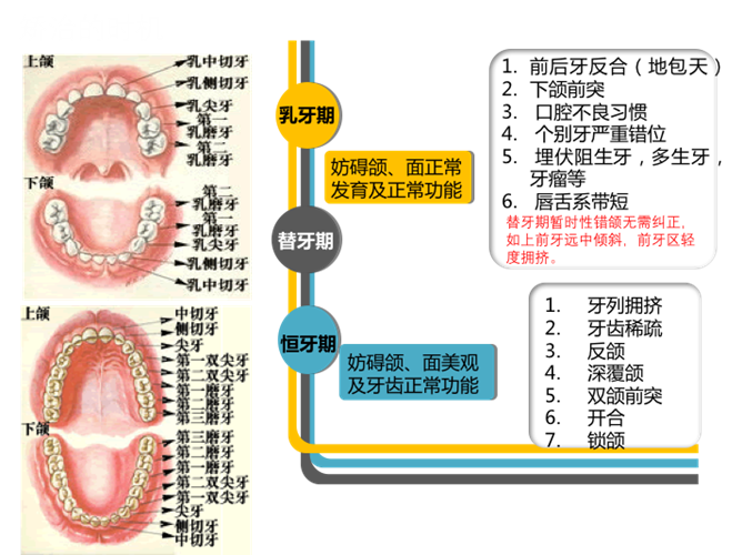 寒假"正畸潮"来临 如何正确应对儿童牙齿畸形?