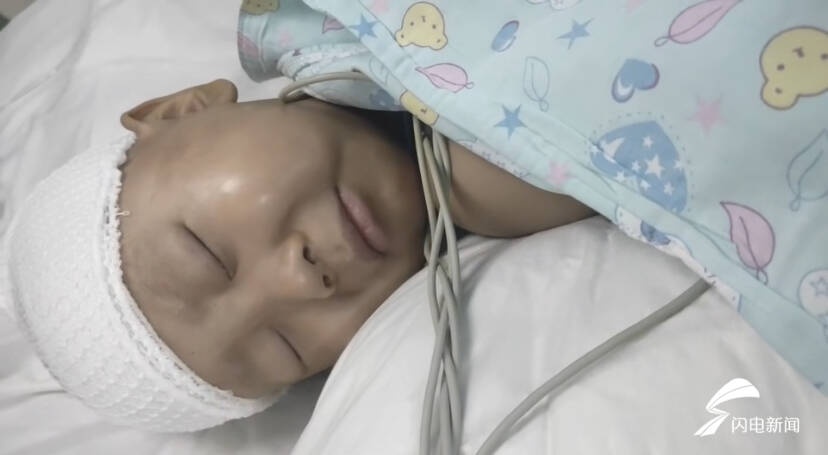 闪电公益|5岁患癌男孩接受头部肿瘤切除手术 仍需筹措第二次手术费用20余万元休闲区蓝鸢梦想 - Www.slyday.coM 闪电公益|5岁患癌男孩接受头部肿瘤切除手术 仍需筹措第二次手术费用20余万元休闲区蓝鸢梦想 - Www.slyday.coM