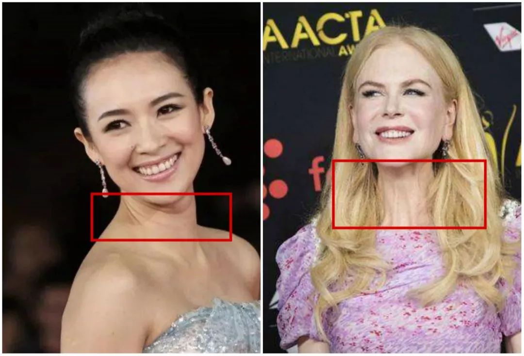 女人别让这个部位暴露年龄抹一抹颈纹变淡年轻10岁