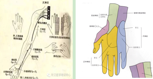 引以为戒穿刺致尺神经损伤转发提醒所有人