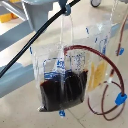 一碗猪脏粉下肚,女子腹痛剧烈抽出"牛奶血"!这习惯很多人都有
