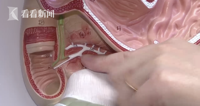 每天3两多烧酒!肚大像“怀胎十月” 男子突发腹痛进了ICU休闲区蓝鸢梦想 - Www.slyday.coM 每天3两多烧酒!肚大像“怀胎十月” 男子突发腹痛进了ICU休闲区蓝鸢梦想 - Www.slyday.coM