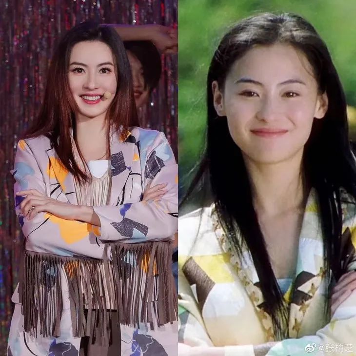 张柏芝脸肿的痛 我终于明白了