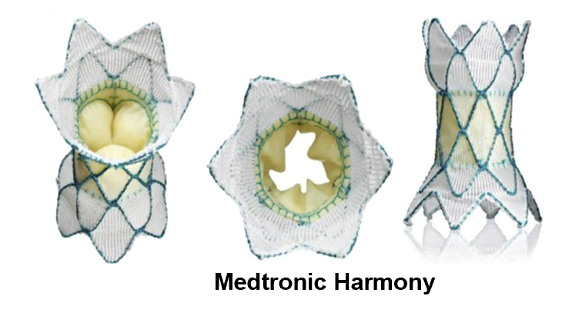 全球首款美敦力harmonytpv瓣膜已获fda批准
