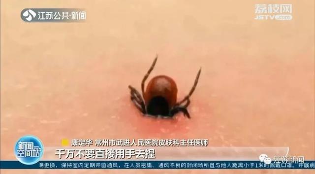 17岁姑娘出现“致命红斑”!此地1死26伤!紧急提醒:清明出游多地有人中招休闲区蓝鸢梦想 - Www.slyday.coM 17岁姑娘出现“致命红斑”!此地1死26伤!紧急提醒:清明出游多地有人中招休闲区蓝鸢梦想 - Www.slyday.coM