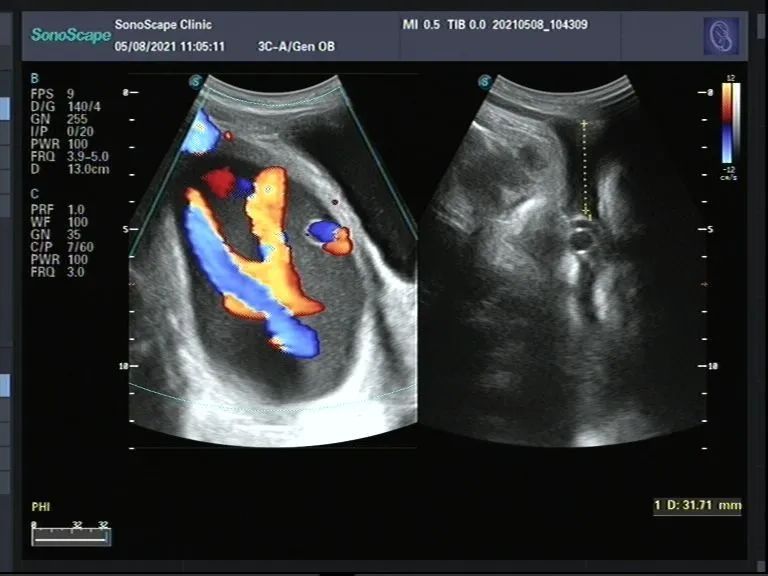 孕妇脐带脱垂、胎儿命悬一线,还好有他们!休闲区蓝鸢梦想 - Www.slyday.coM 孕妇脐带脱垂、胎儿命悬一线,还好有他们!休闲区蓝鸢梦想 - Www.slyday.coM