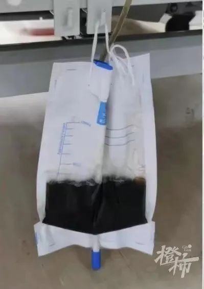 63岁大伯抓毒蛇泡药酒,反被咬一口!他立马用嘴吸伤口,最后躺进了医院……休闲区蓝鸢梦想 - Www.slyday.coM 63岁大伯抓毒蛇泡药酒,反被咬一口!他立马用嘴吸伤口,最后躺进了医院……休闲区蓝鸢梦想 - Www.slyday.coM