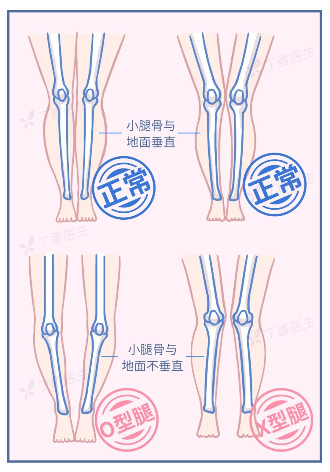 图片来源：自己画的