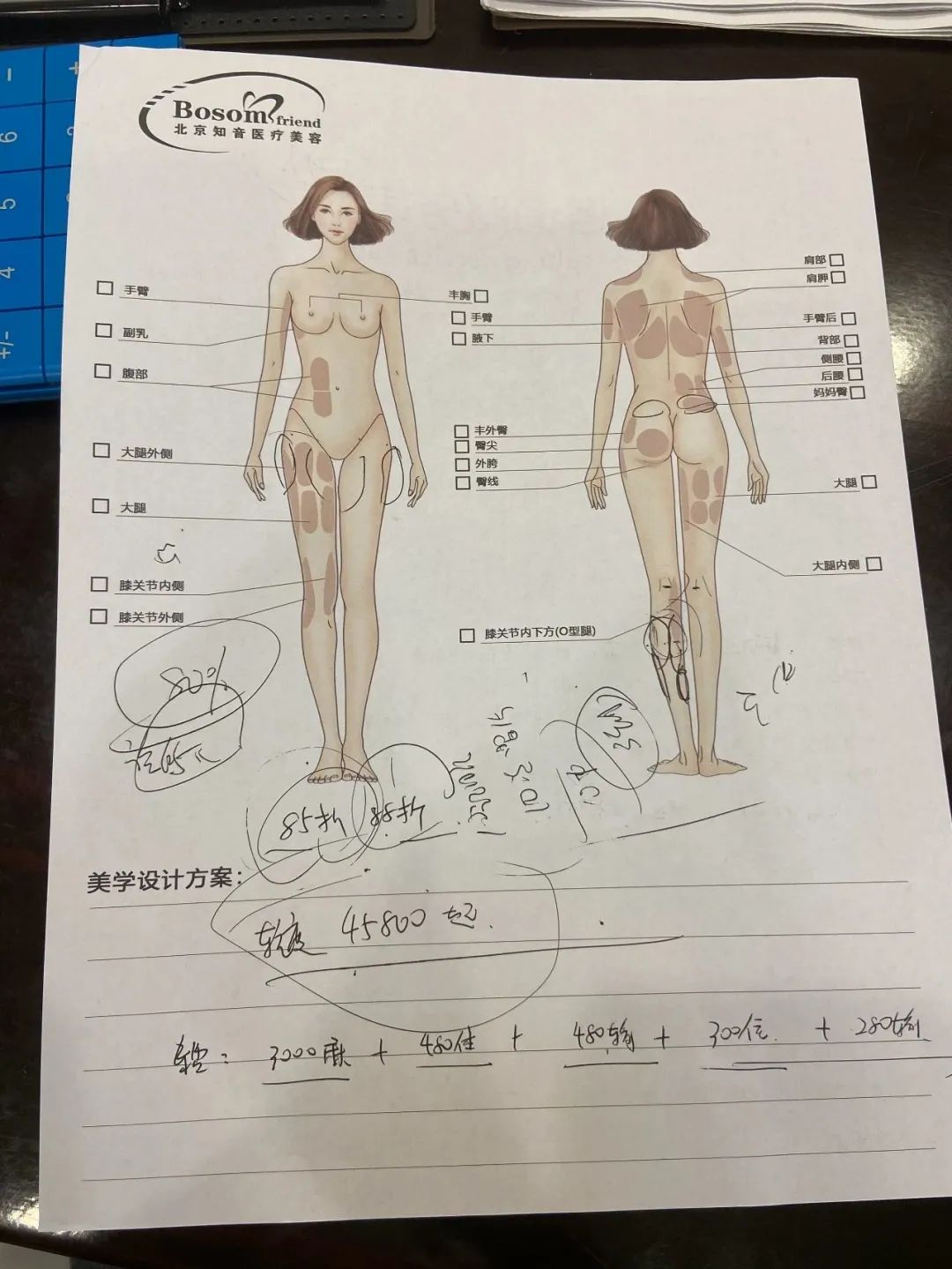 北京知音医疗美容门诊部向新京报记者出示的小腿肌肉阻断术示意图与价格。新京报记者李雨凝 摄