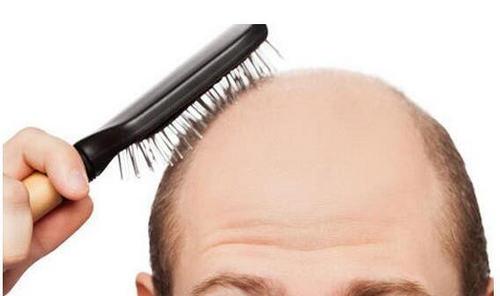 每天头发脱落不超过100根算正常,如何预防?休闲区蓝鸢梦想 - Www.slyday.coM 每天头发脱落不超过100根算正常,如何预防?休闲区蓝鸢梦想 - Www.slyday.coM