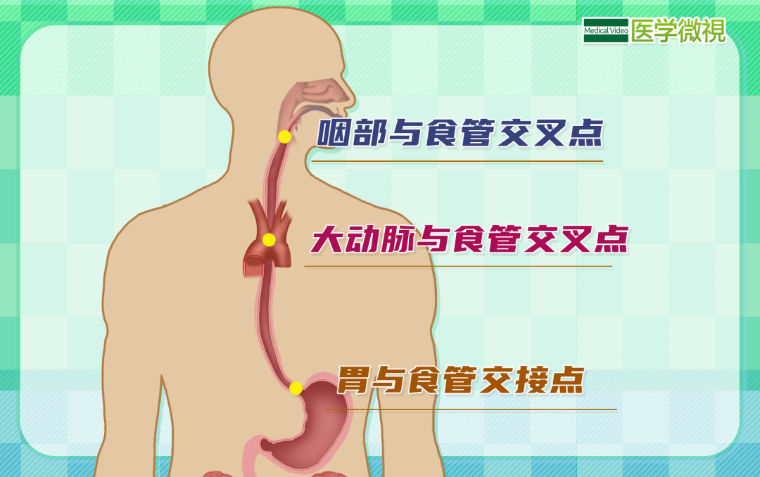 99的食管癌患者都有这种习惯