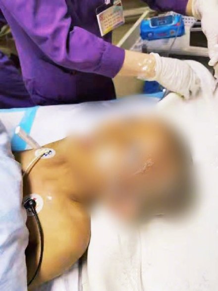 女子误信“偏方”,用农药给11岁女儿焗头驱虱,导致女儿中毒被送进ICU休闲区蓝鸢梦想 - Www.slyday.coM 女子误信“偏方”,用农药给11岁女儿焗头驱虱,导致女儿中毒被送进ICU休闲区蓝鸢梦想 - Www.slyday.coM