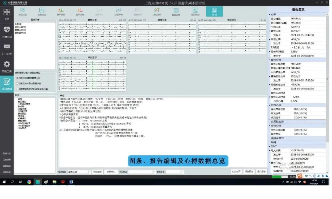 怎么装动态心电图必须掌握的心律失常49问_https://www.jmylbn.com_新闻资讯_第12张