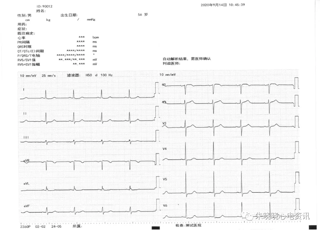 怎么装动态心电图必须掌握的心律失常49问_https://www.jmylbn.com_新闻资讯_第9张