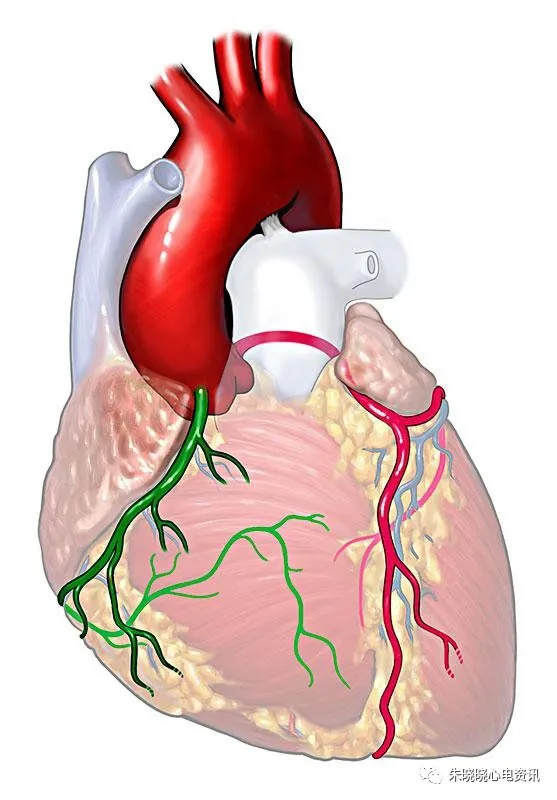 怎么装动态心电图必须掌握的心律失常49问_https://www.jmylbn.com_新闻资讯_第4张
