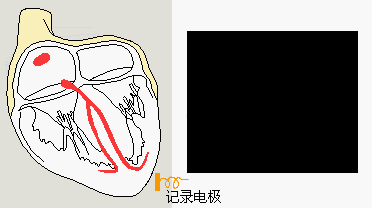怎么装动态心电图必须掌握的心律失常49问_https://www.jmylbn.com_新闻资讯_第2张