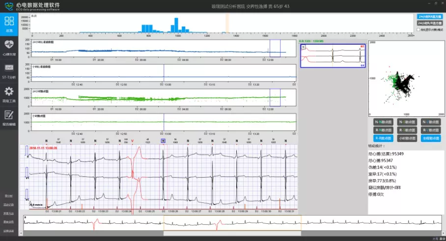 怎么装动态心电图必须掌握的心律失常49问_https://www.jmylbn.com_新闻资讯_第11张