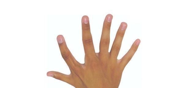 巴西家族为自己有十二根手指感到自豪第六根手指用处太大