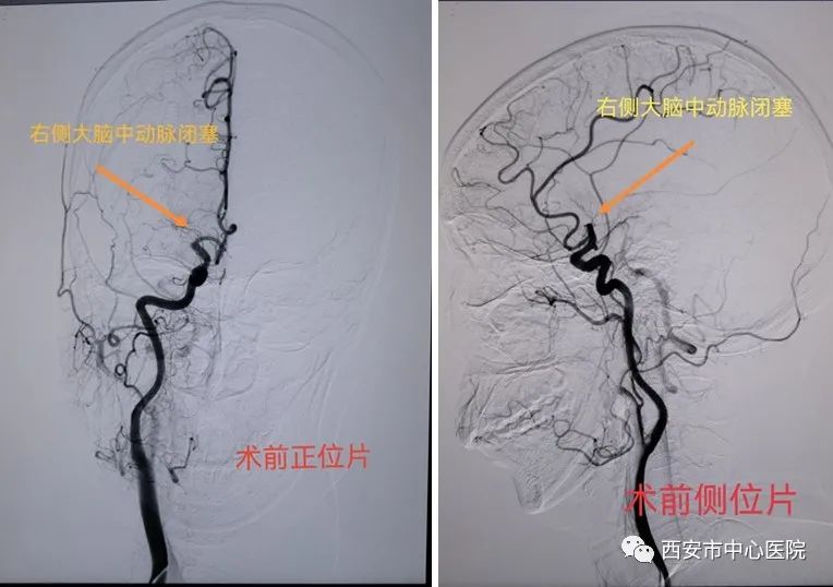 防控疫情与救治生命同时进行——西安市中心医院成功救治一例在管控区内的危重症患者休闲区蓝鸢梦想 - Www.slyday.coM 防控疫情与救治生命同时进行——西安市中心医院成功救治一例在管控区内的危重症患者休闲区蓝鸢梦想 - Www.slyday.coM
