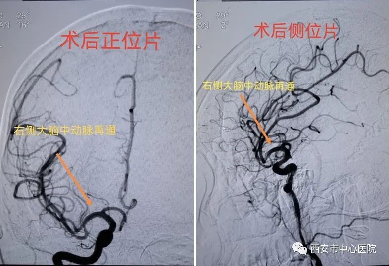 防控疫情与救治生命同时进行——西安市中心医院成功救治一例在管控区内的危重症患者休闲区蓝鸢梦想 - Www.slyday.coM 防控疫情与救治生命同时进行——西安市中心医院成功救治一例在管控区内的危重症患者休闲区蓝鸢梦想 - Www.slyday.coM
