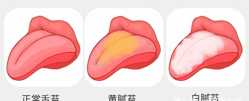 小儿舌苔厚黄如何调理