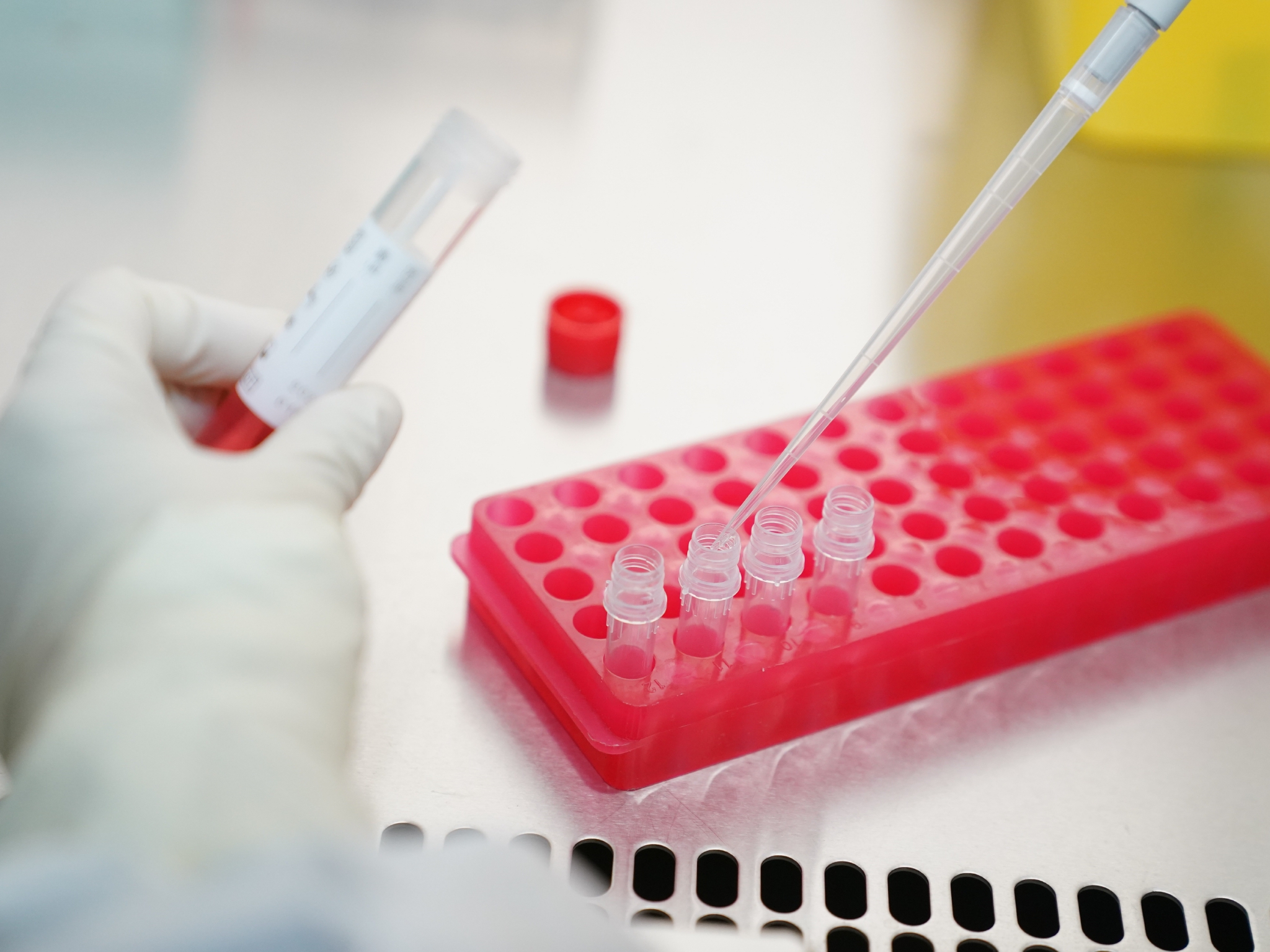 新闻晚8点|北京市海淀区报告1例核酸阳性人员休闲区蓝鸢梦想 - Www.slyday.coM 新闻晚8点|北京市海淀区报告1例核酸阳性人员休闲区蓝鸢梦想 - Www.slyday.coM