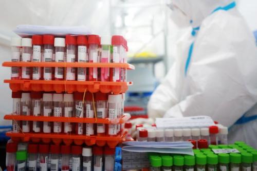 云南新增本土确诊病例1例无症状感染者2例 均在边境小城勐腊休闲区蓝鸢梦想 - Www.slyday.coM 云南新增本土确诊病例1例无症状感染者2例 均在边境小城勐腊休闲区蓝鸢梦想 - Www.slyday.coM