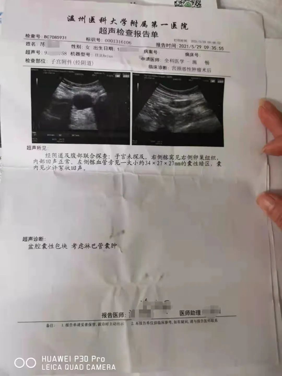 已切除了子宫,体检报告却显示子宫正常,迪安美生这是啥操作?