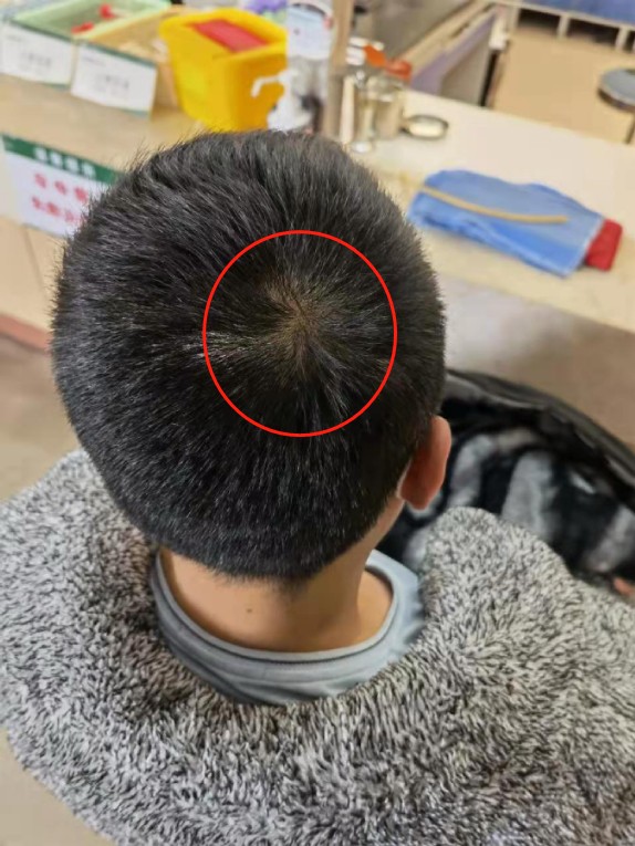 男子入室盗窃,监控没拍到正脸,浙江民警凭一个后脑勺,成功破案!休闲区蓝鸢梦想 - Www.slyday.coM 男子入室盗窃,监控没拍到正脸,浙江民警凭一个后脑勺,成功破案!休闲区蓝鸢梦想 - Www.slyday.coM