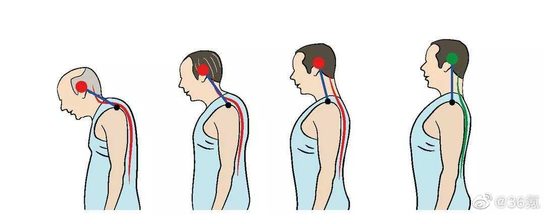 经常驼背脸会变大,是谁偷偷把背挺直了?休闲区蓝鸢梦想 - Www.slyday.coM 经常驼背脸会变大,是谁偷偷把背挺直了?休闲区蓝鸢梦想 - Www.slyday.coM