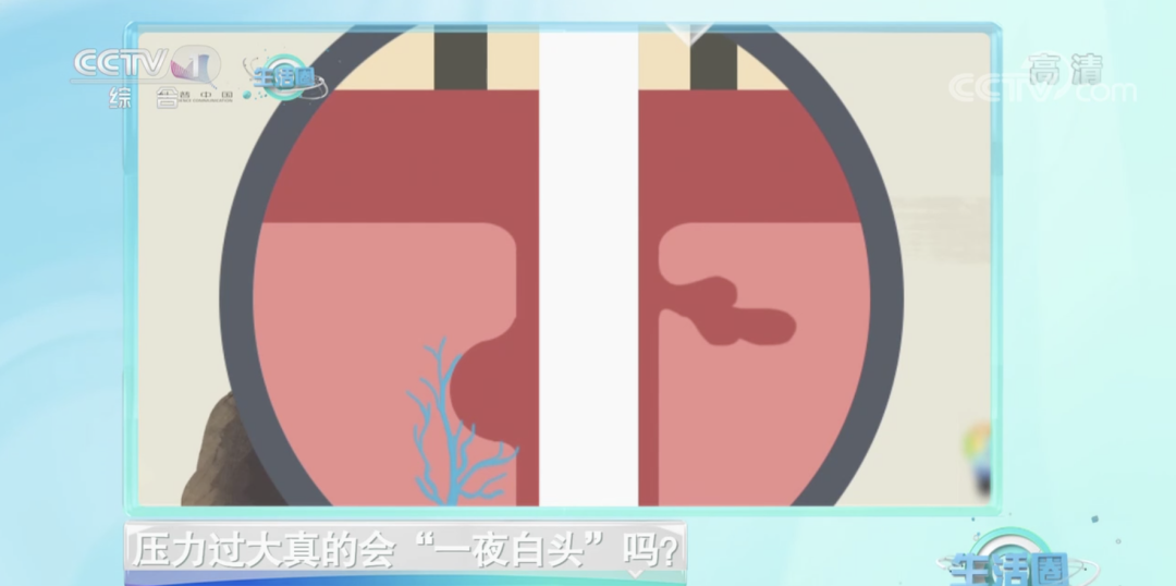 “少白头”是怎么回事儿?为什么压力大时会长白头发?这些习惯可能会催生白发......休闲区蓝鸢梦想 - Www.slyday.coM “少白头”是怎么回事儿?为什么压力大时会长白头发?这些习惯可能会催生白发......休闲区蓝鸢梦想 - Www.slyday.coM
