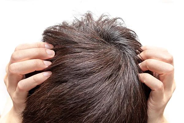 “少白头”是怎么回事儿?为什么压力大时会长白头发?这些习惯可能会催生白发......休闲区蓝鸢梦想 - Www.slyday.coM “少白头”是怎么回事儿?为什么压力大时会长白头发?这些习惯可能会催生白发......休闲区蓝鸢梦想 - Www.slyday.coM