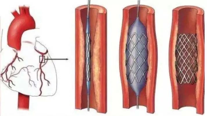 网传字节跳动28岁员工加班猝死,刚刚公司内网发布声明!猝死前有哪些信号?医生这样说休闲区蓝鸢梦想 - Www.slyday.coM 网传字节跳动28岁员工加班猝死,刚刚公司内网发布声明!猝死前有哪些信号?医生这样说休闲区蓝鸢梦想 - Www.slyday.coM