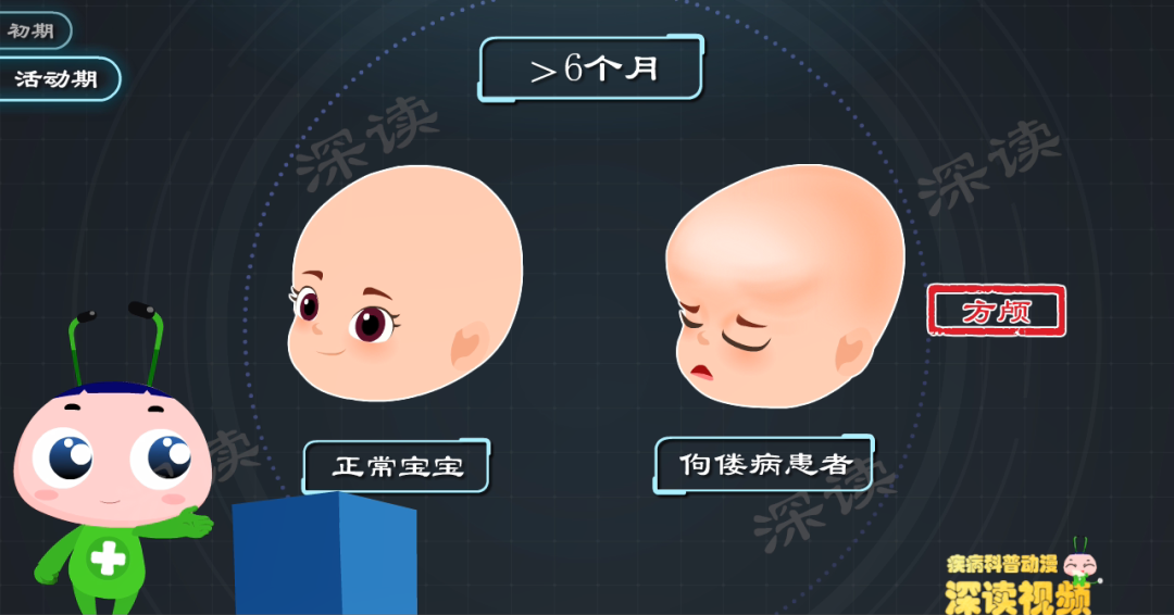 6个月后宝宝出现头围增大,头颅外观呈方形等情况,医学上称之为"方颅.