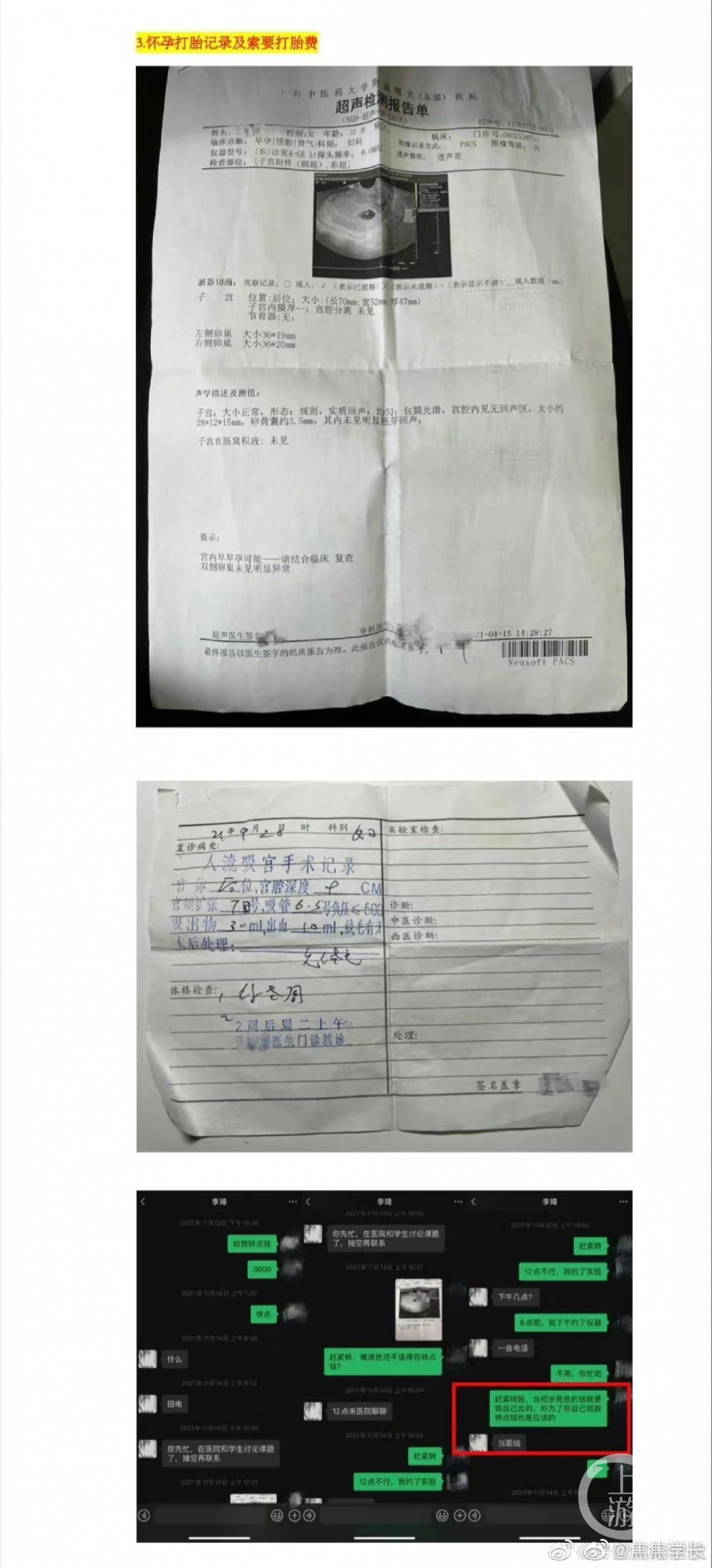 举报女生表示,人流手术后,李某表示是正常情况.